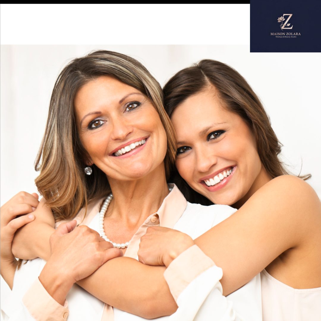 Natural Dysport treatment results at Maison Zolara in Lansing, MI