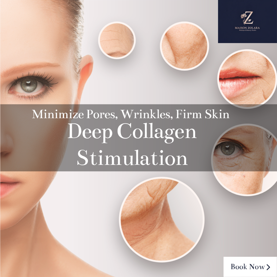 Glowing client after Candela Matrix RF microneedling — Maison Zolara, Lansing MI